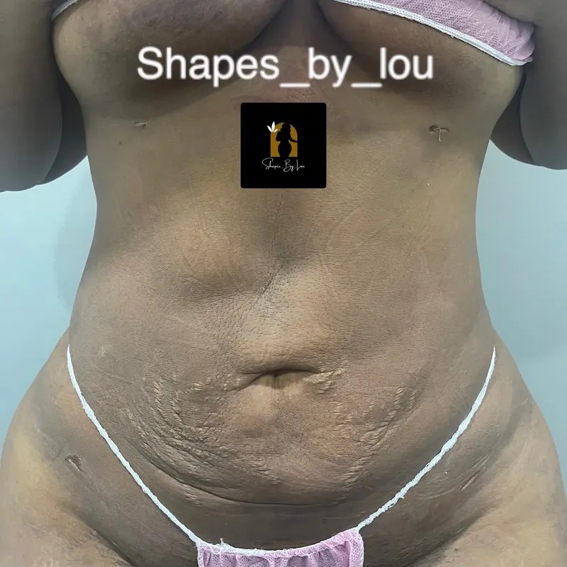 Client recovery photo