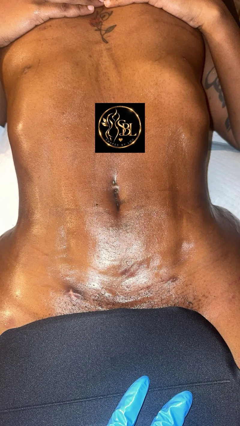 Client recovery photo