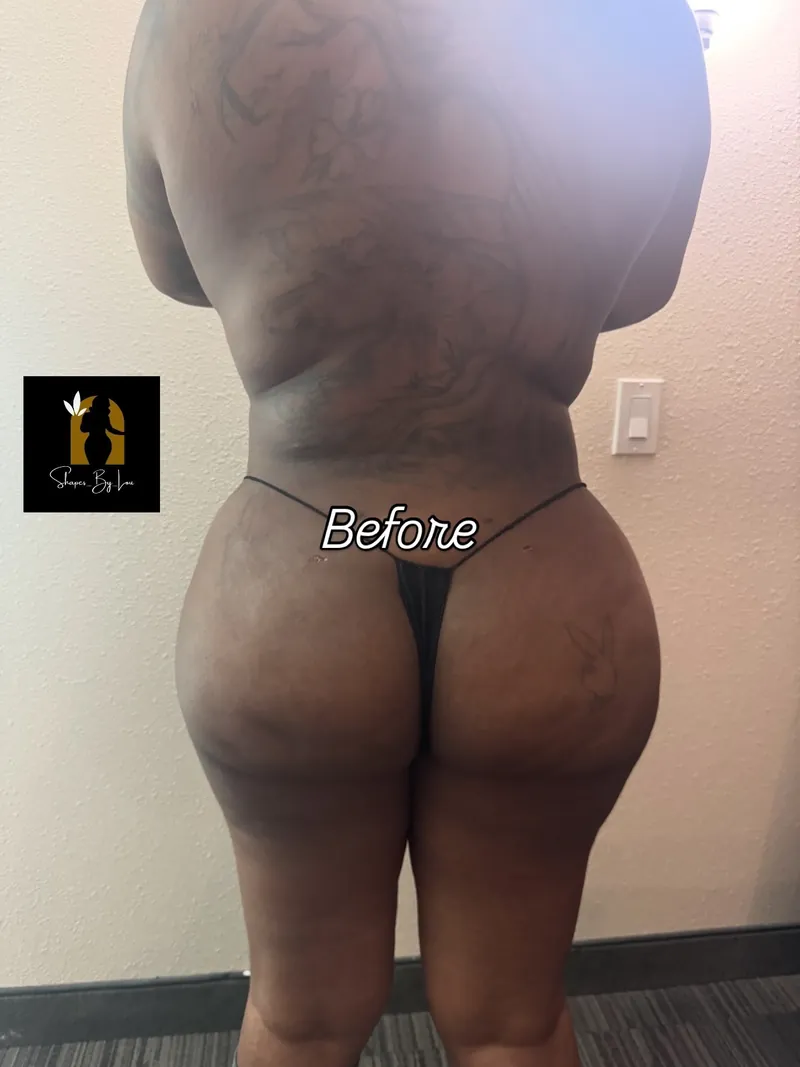 Client back photo labeled before