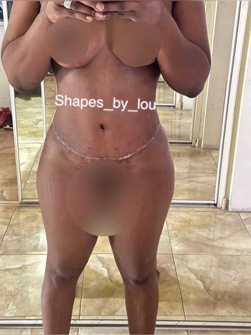 Client recovery photo
