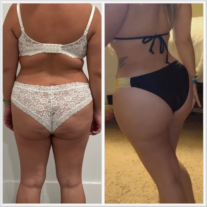 Client back photos side by side